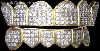 Prong Set Diamond Grillz Grillz