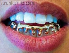 Gold Drip Grillz