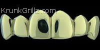 Polished Gold Grillz Grillz