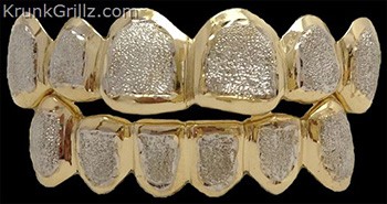 Border Diamond Dust Grillz  Grillz