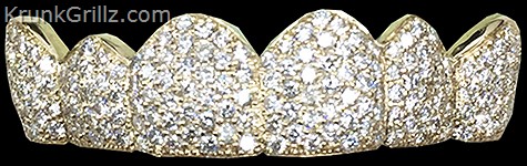 Sparkling Pavé Diamond Grillz Grillz