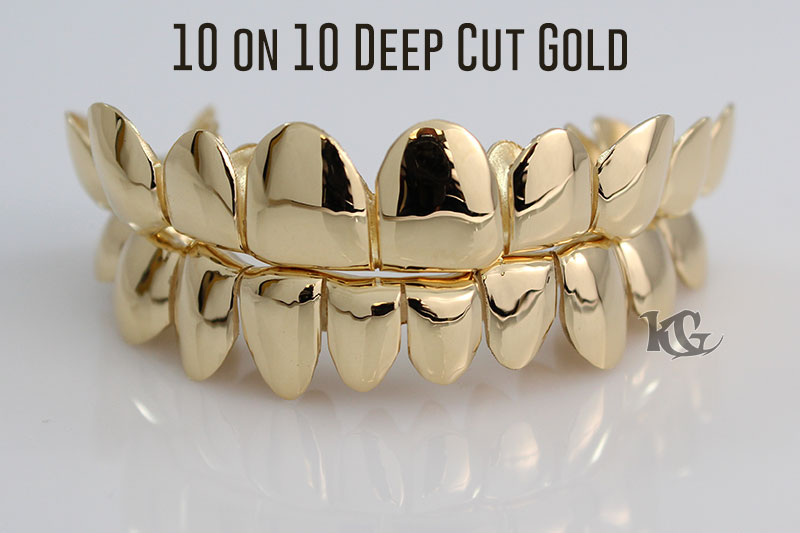 Polished Gold Grillz