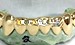 14k yellow gold grillz