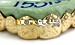 14kt gold teeth