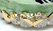 buy gold teeth online