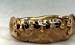 custom drip grillz