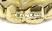 custom gold teeth