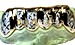diamond cut gold teeth