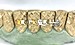 diamond dust cut gold teeth