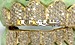 diamond grillz top and bottom