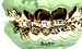 gold diamond cut grillz