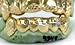 gold grillz set