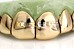 gold grillz