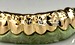 grills for your bottom teeth