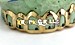 open face gold crown tooth