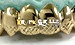 real gold fang grillz
