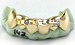 top and bottom fang grillz